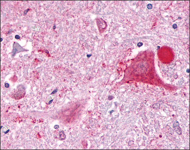 Anti-GPR63 antibody produced in rabbit