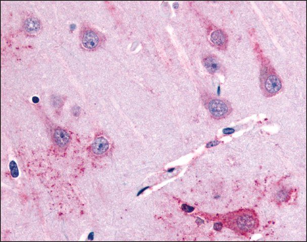 Anti-GPR39 antibody produced in rabbit