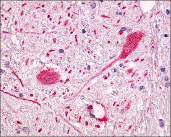 Anti-GPR55 antibody produced in rabbit