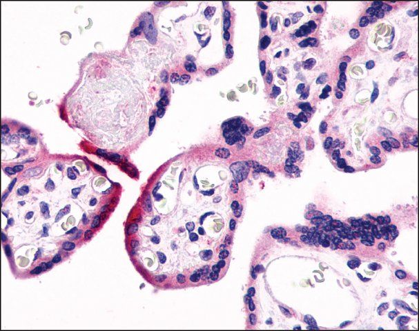 Anti-GPR78 antibody produced in rabbit