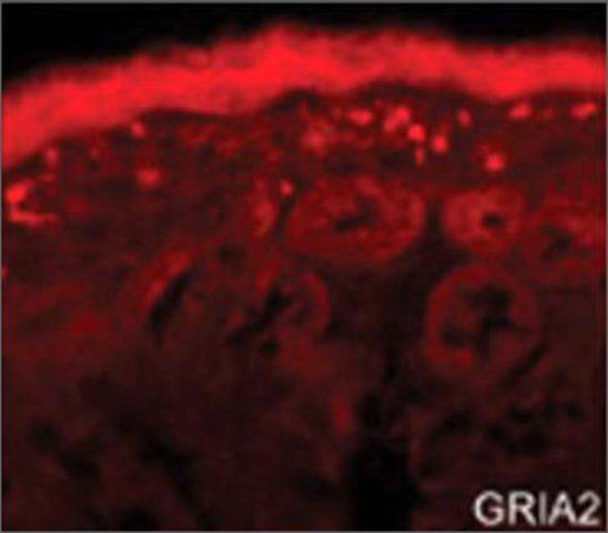 Anti-GRIA2 (AB2) antibody produced in rabbit