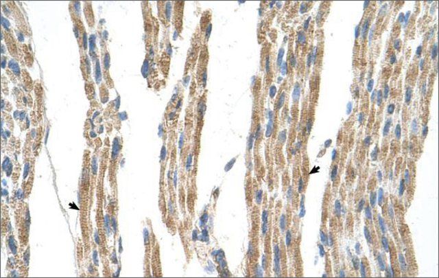 Anti-GPT (AB3) antibody produced in rabbit