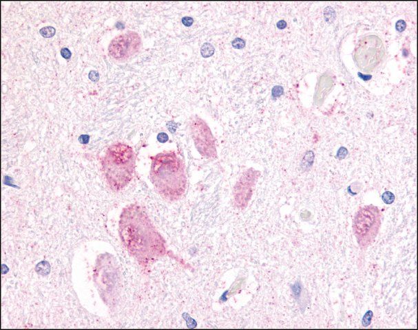 Anti-GPR45 antibody produced in rabbit