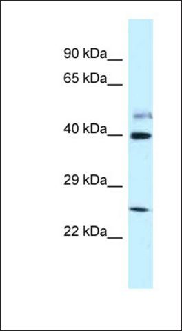 Anti-GRINL1A antibody produced in rabbit