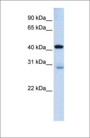 Anti-GRAMD2 antibody produced in rabbit