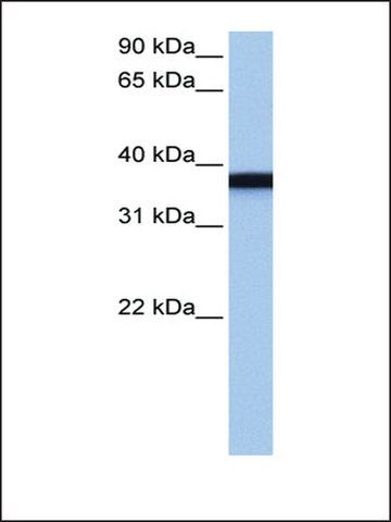 Anti-GSG1 (AB3) antibody produced in rabbit