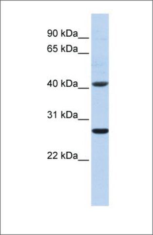 Anti-GSTM5 antibody produced in rabbit