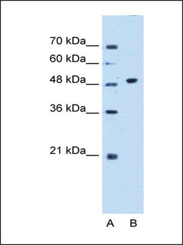 Anti-GTDC1 antibody produced in rabbit