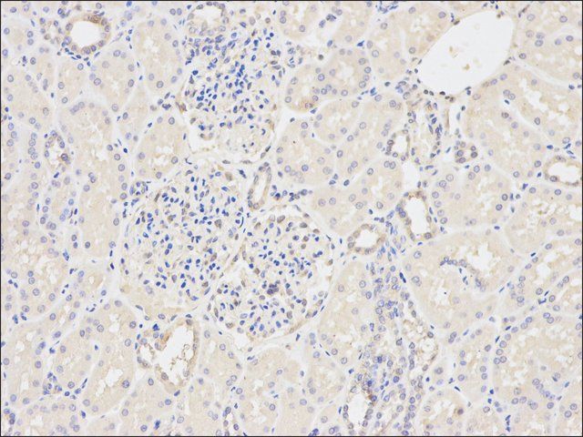 Anti-GSTM2 antibody produced in rabbit