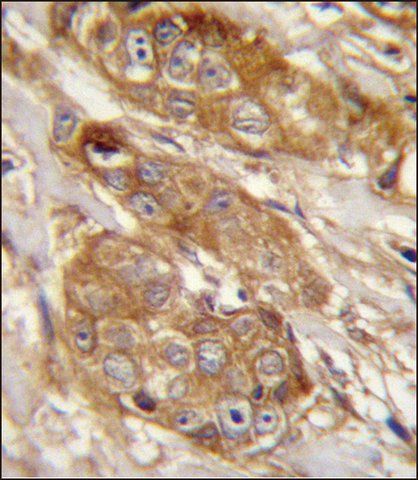 ANTI-GRINA (CENTER) antibody produced in rabbit