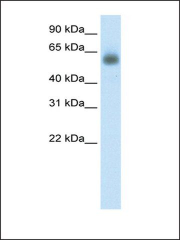 Anti-GRHL3 (AB1) antibody produced in rabbit