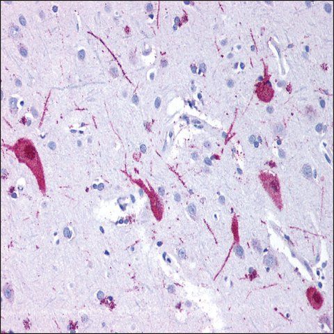 Anti-GRM4 / MGLUR4 antibody produced in rabbit