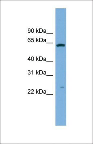 Anti-GSTA3 antibody produced in rabbit