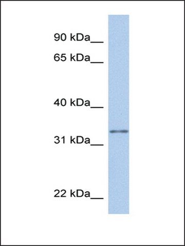 Anti-GSTO2 antibody produced in rabbit