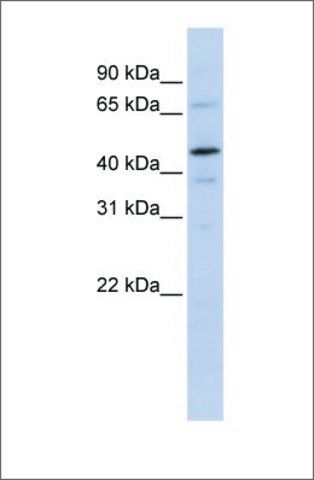 Anti-GTF2E1 antibody produced in rabbit