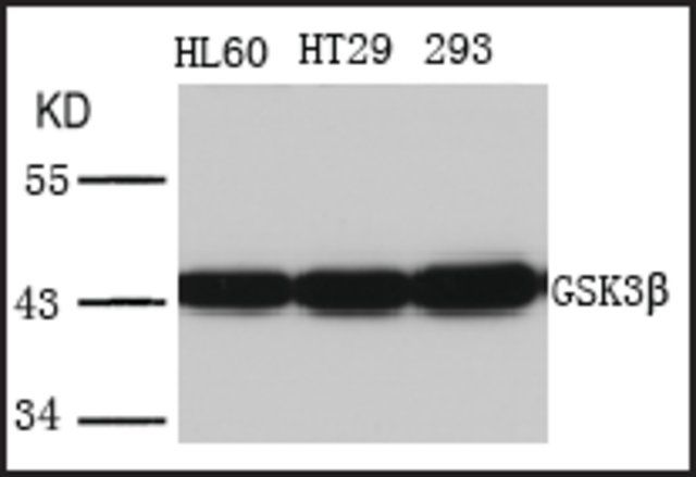 Anti-GSK3B (Ab-216) antibody produced in rabbit