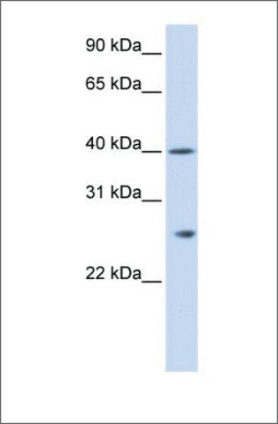 Anti-GSTK1 antibody produced in rabbit