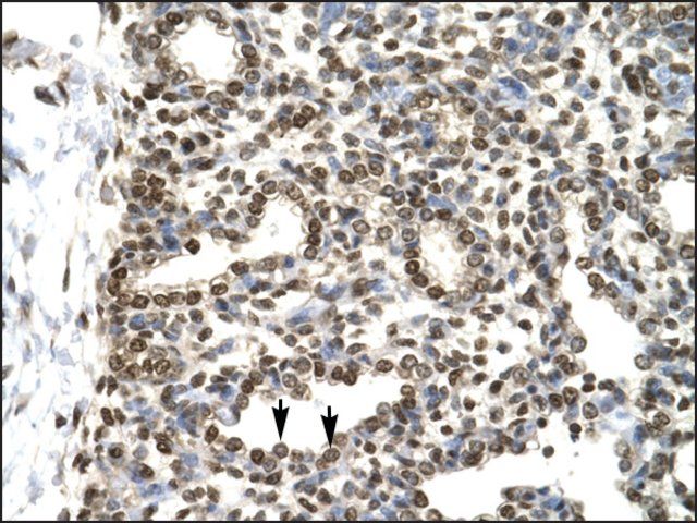 Anti-GTF2H2 antibody produced in rabbit