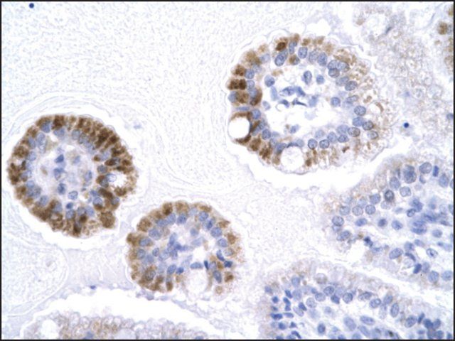 Anti-GTF2B antibody produced in rabbit