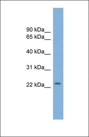 Anti-GRPEL1, (N-terminal) antibody produced in rabbit