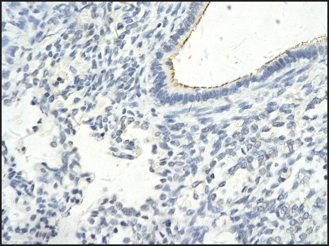 Anti-GTF2F1, (N-terminal) antibody produced in rabbit