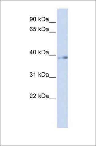 Anti-GTF2H2 antibody produced in rabbit