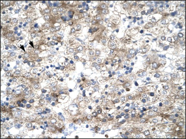 Anti-GTF2H1 antibody produced in rabbit