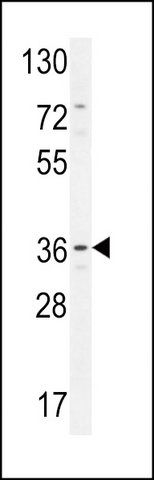 ANTI-GRINA (CENTER) antibody produced in rabbit