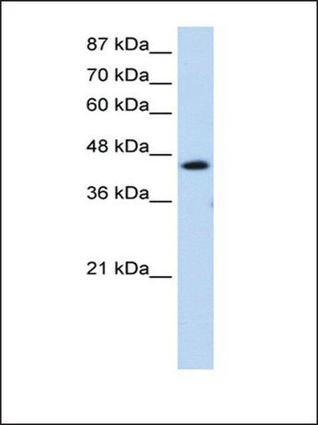 Anti-GTF2H4 (AB2) antibody produced in rabbit