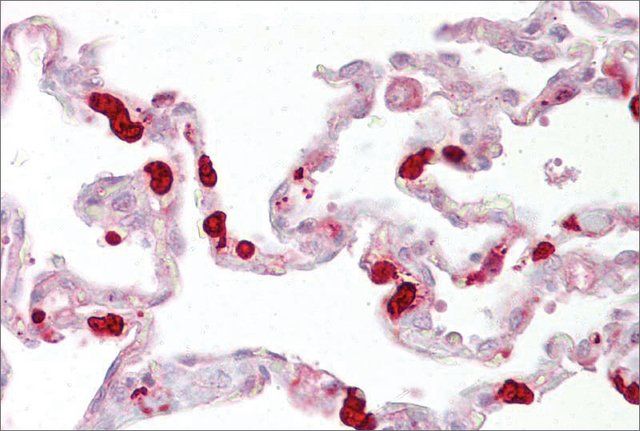 Anti-GSTT1 antibody produced in rabbit