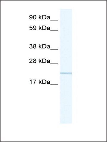 Anti-GTL3 antibody produced in rabbit