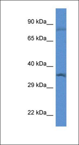 Anti-GTF2B antibody produced in rabbit