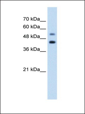 Anti-GTPBP2 antibody produced in rabbit