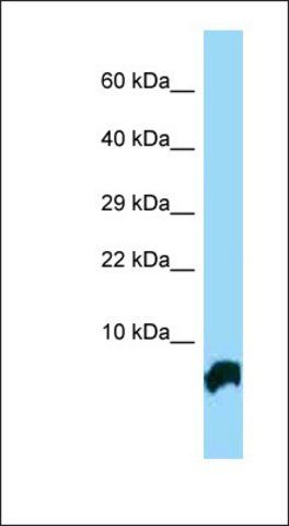 Anti-GTF2H5 antibody produced in rabbit