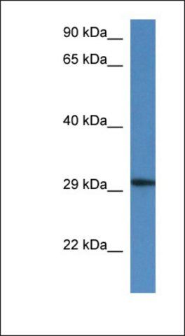 Anti-HARBI1 antibody produced in rabbit