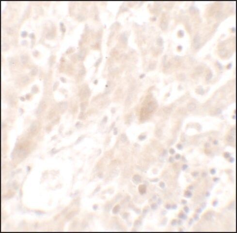 Anti-DHX36 antibody produced in rabbit