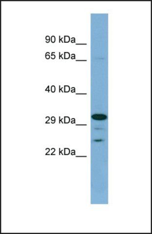 Anti-DHRS9 antibody produced in rabbit