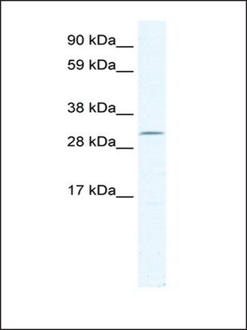 Anti-DMRT2 (AB2) antibody produced in rabbit