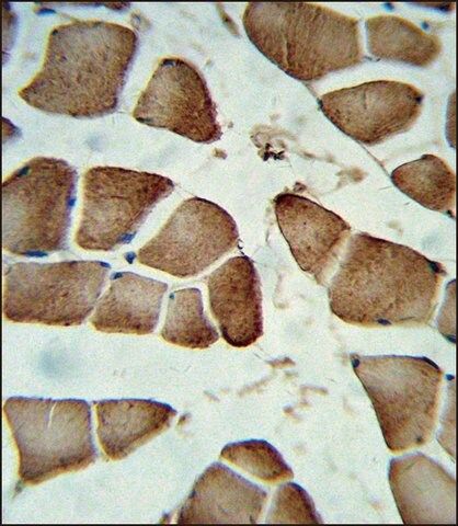 ANTI-DIPA (CENTER) antibody produced in rabbit