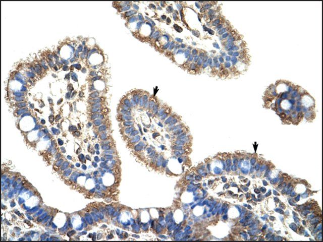 Anti-DMTF1 (AB1) antibody produced in rabbit