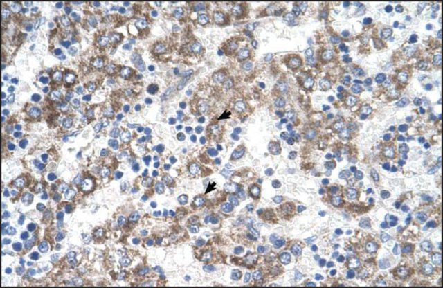 Anti-DLX5 (AB2) antibody produced in rabbit