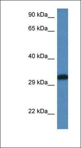 Anti-DLX6 antibody produced in rabbit