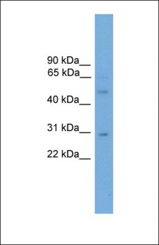 Anti-DMRT3 antibody produced in rabbit