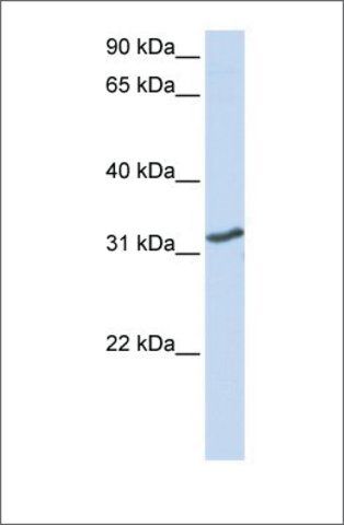 Anti-DLX3 antibody produced in rabbit