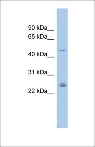 Anti-DMRT3 antibody produced in rabbit