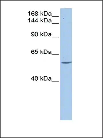 Anti-DLC1 antibody produced in rabbit