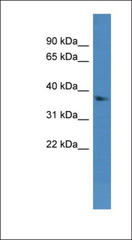 Anti-DHRS7 antibody produced in rabbit