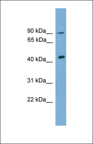 Anti-DMRT1, (C-terminal) antibody produced in rabbit