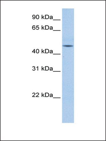 Anti-DKFZP779O175 antibody produced in rabbit