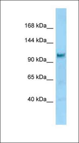 Anti-DIAPH2 antibody produced in rabbit